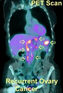 Are you sure your radiology results are correct?